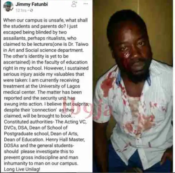 UNILAG Student Survives Ritualist Attack On Campus (Photo)